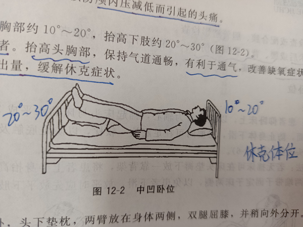 大S為何常臥？深度剖析其背后的多重原因與健康管理之道