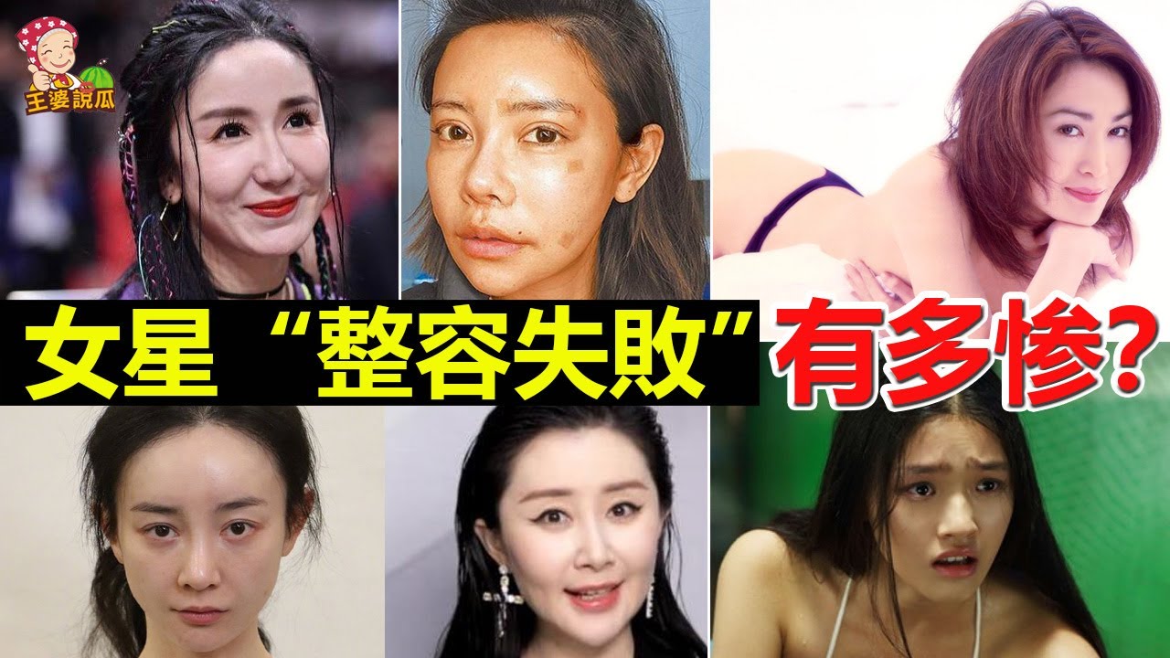 深度解析：整容很好看的女明星，如何做到自然美的典范？